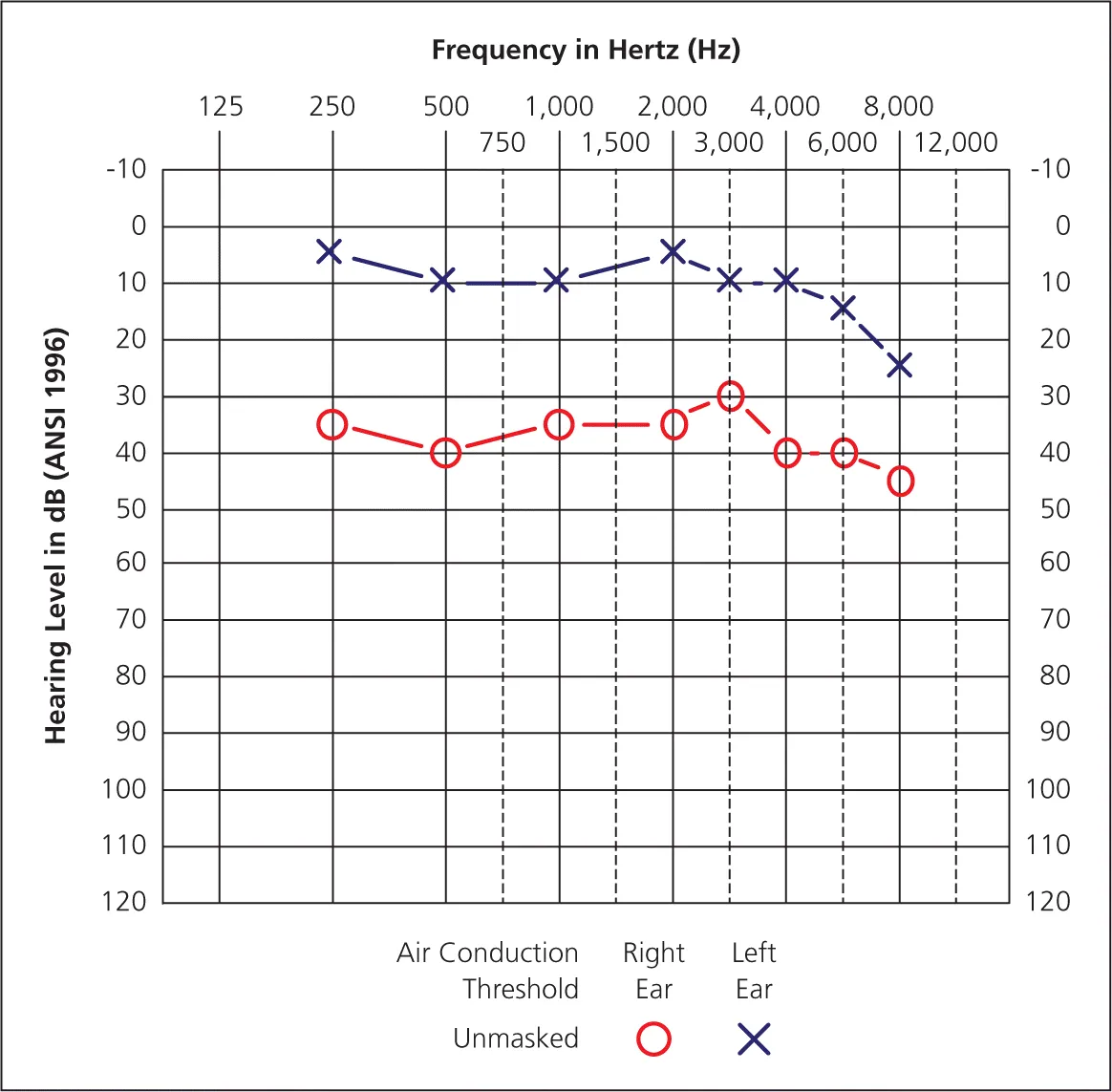 loss of hearing